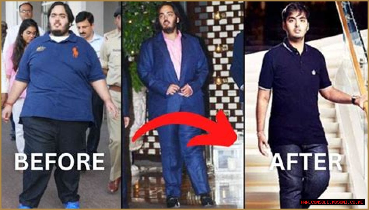Anant Ambani's Health Journey: Is His Disease Curable Or Not?