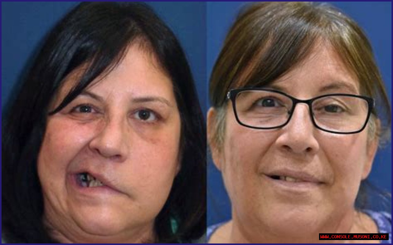 Pioneer Woman Stroke: Cause Of Death, Cancer Update, And Legacy